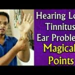 Acupressure Points For All EAR Problems , Hearing Loss , TINNITUS , Ear Pain , Deafness – In Hindi