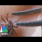 New research may reveal why Lyme disease causes chronic symptoms for some