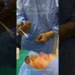 Deviated Septum, Why You Must Get It Fixed!