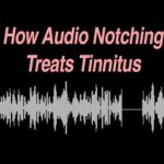How Audio Notching Treats Tinnitus