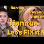 Simpleng Paraan: Maingay, Ringing Sa Ear or Tinnitus. Gawin ito with Dr. Jun