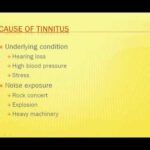 Cause of Tinnitus